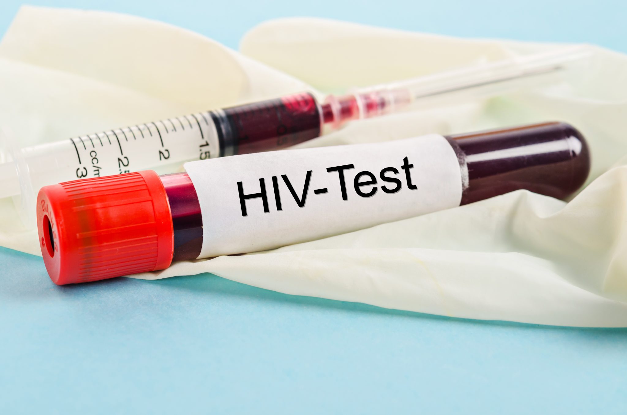 HIV und Aids