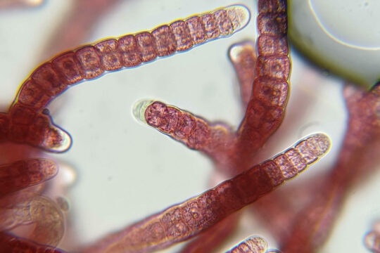 Es sind Rotalgen unter dem Mikroskop zu sehen, welche eingesetzt in Rinderfutter bei der Methangasreduktion hilfreich sein können.